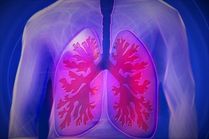 Pulmonary Embolism (Blood Clots in the Lungs): Risk Factors & Signs of a Silent Killer