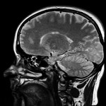 The Amazing Blood-Brain Barrier